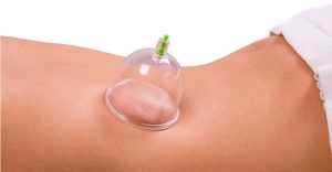 Cupping massage i Lyngby